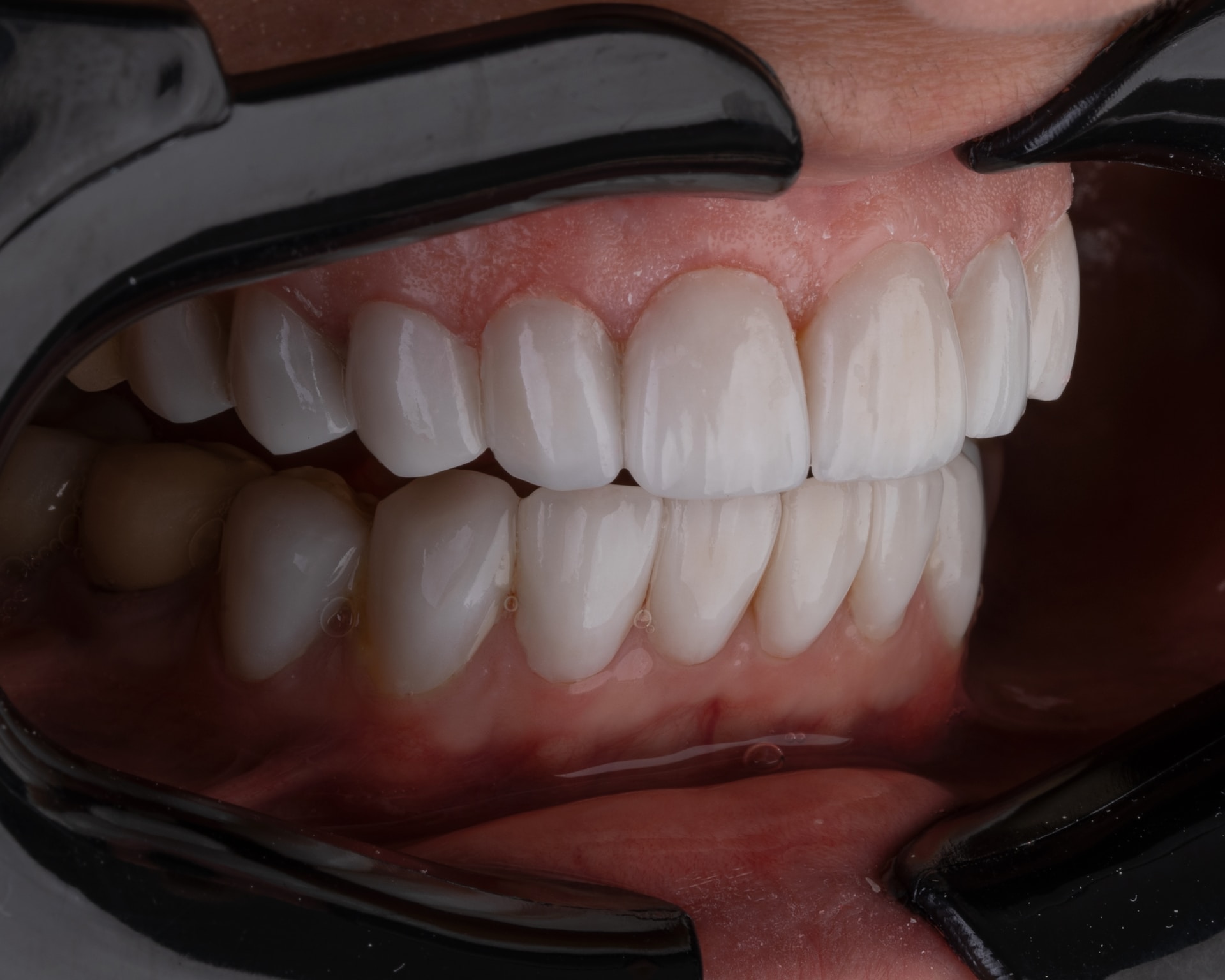 Rehabilitacja stomatologiczna – kiedy warto ją rozważyć?