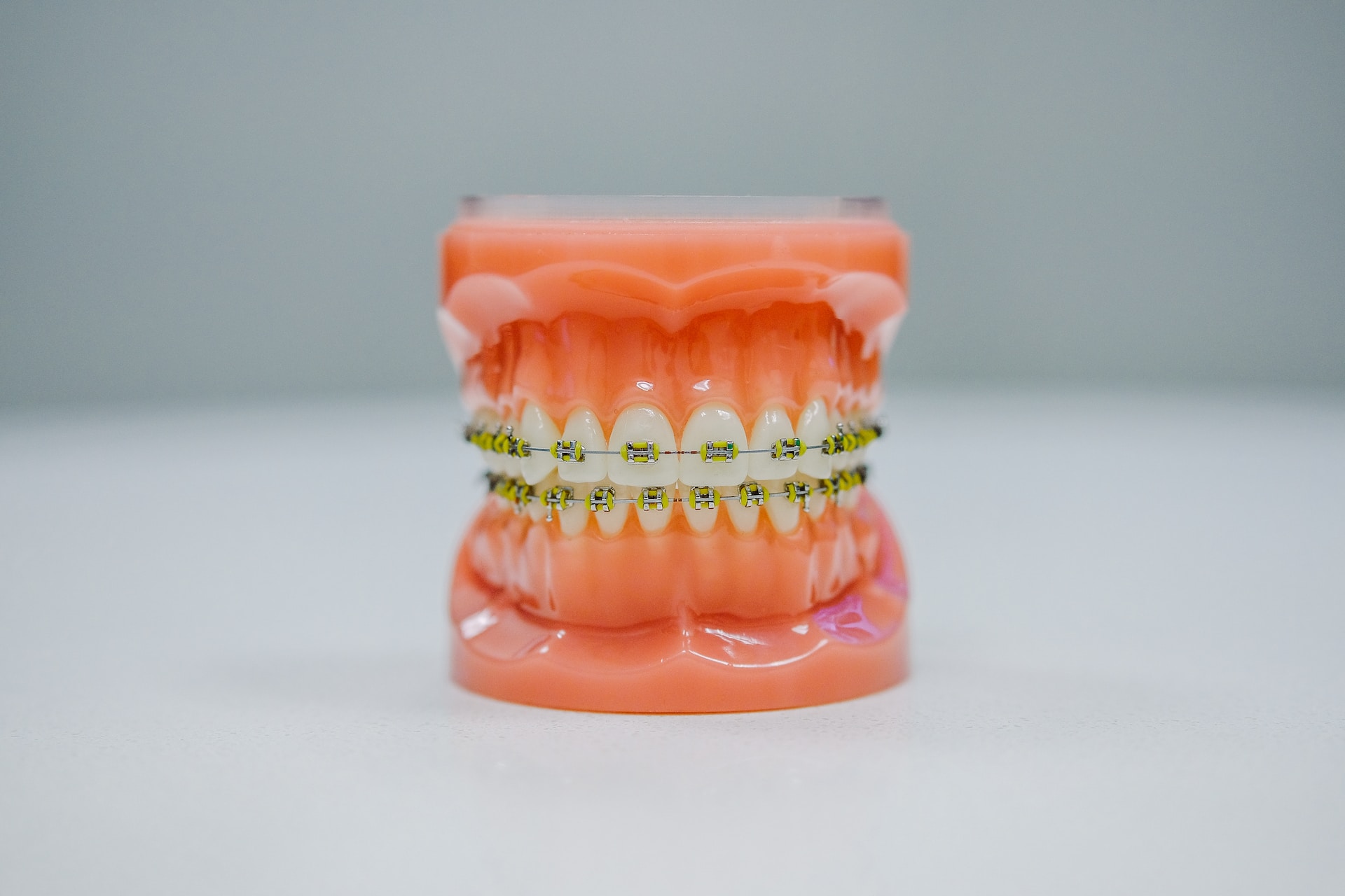 Kiedy warto udać się do ortodonty?