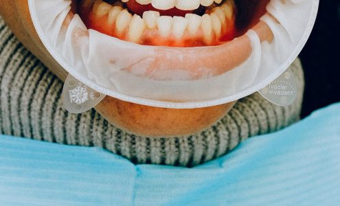 Jak przezwyciężyć strach przed leczeniem ortodontycznym?