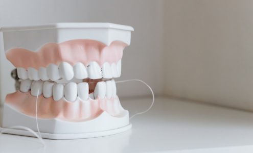 Kiedy korony zębowe są konieczne?